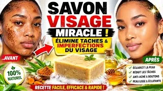 Miniature : Comment Fabriquer un Savon Visage Naturel pour une Peau Sans Taches ni Boutons