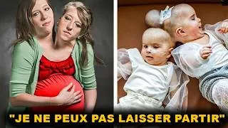 Miniature : La mère des jumeaux siamois a confirmé que les horribles rumeurs étaient vraies