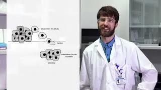 Miniature : Zoom sur la recherche contre le cancer: comment prévenir la dissémination des cellules cancéreuses?