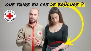 Miniature : Que faire en cas de brûlure ?