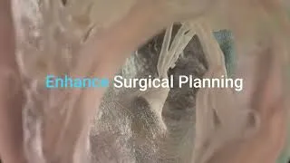 Miniature : Découvrez la J5 Digital Anatomy de Stratasys