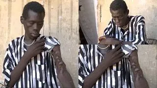 Miniature : Atteint d'une insuffisance rénale : Serigne Saliou demande de l'aide "Guir Yalla Naniouma Japalé"
