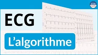Miniature : Interprétation ECG : étape par étape