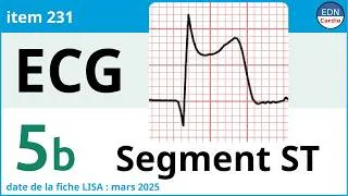 Miniature : 231 - Electrocardiogramme (ECG) - Partie 5b - Physiopathologie du segment ST