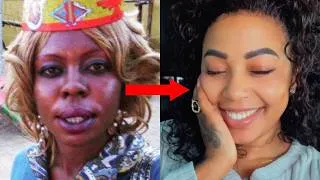 Miniature : 10 Célébrités Africaines Qui Se Sont Dépigmentées à l'Extrême