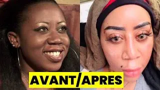 Miniature : 10 actrices de Nollywood détruites par la chirurgie