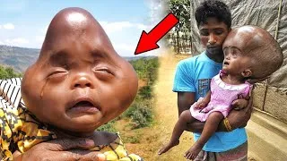Miniature : 8 bébés inhabituels que vous n'avez jamais vus