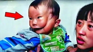 Miniature : 8 Enfants incroyables atteints des conditions de naissance les plus rares au monde.
