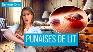 Miniature : Punaises de lit : comment les éviter et/ou traiter sa maison ?