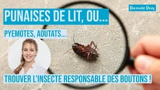 Miniature : Punaises de lit, ou autres insectes ? Comment identifier les coupables des piqures !  @DermatoDrey