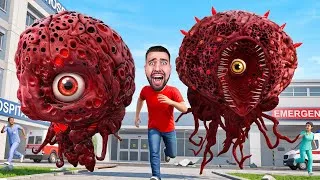 Miniature : LE CERVEAU TRYPOPHOBIE S’ÉCHAPPE DE L’HÔPITAL + MEMBRES DU CORPS TRYPOPHOBIE !!