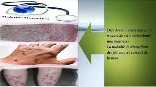 Miniature : Dangers de la nanotechnologie