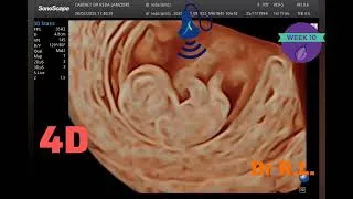 Miniature : ✨ Échographie de grossesse à 10 SA : Une fenêtre sur la vie ! ✨