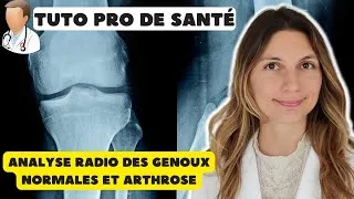 Miniature : Comment interpréter radiographie genou ?