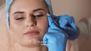 Miniature : Toxine botulique, le visage au naturel