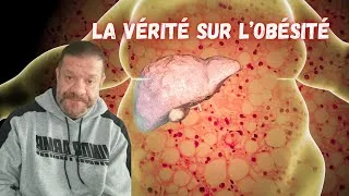 Miniature : Obésité, comment s'en sortir ?