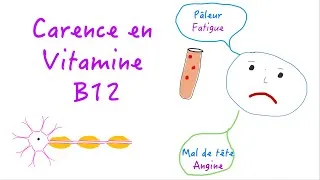 Miniature : Déficit en vitamine B12 - Causes, Symptômes, Diagnostic et Prise en charge