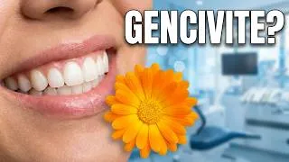 Miniature : Le secret de la Calendula : Guérir la gingivite naturellement
