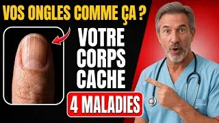 Miniature :  🚨Alerte : si vos ONGLES ressemblent à ÇA après 60 ans, votre corps pourrait cacher 4 maladies