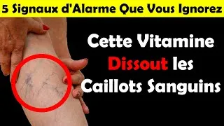 Miniature : Cette Vitamine Dissout les Caillots Sanguins : 5 Signaux d'Alarme Que Vous Ignorez