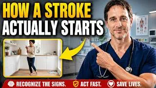 Miniature : •Doctors Are Warning Seniors: This Is What a Stroke Looks Like 24 Hours Before It Hits