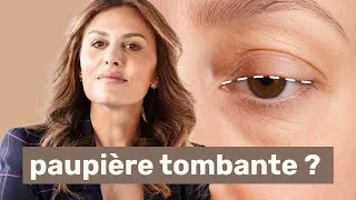 Miniature : Comment traiter les paupières tombantes ?