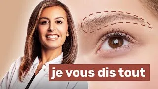 Miniature : GREFFE DE SOURCILS : Tout ce que vous devez savoir !