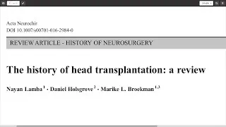 Miniature : L'histoire de la transplantation de tête: une revue