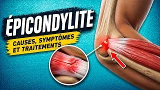 Miniature : EPICONDYLITE (tendinite latérale du coude) : Explications, Causes et  Traitements