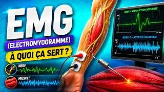 Miniature : ELECTROMYOGRAMME (E.M.G.) : De quoi s'agit il ?