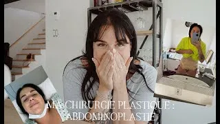 Miniature : Mon abdominoplastie | Première partie