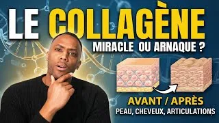 Miniature : C’est quoi le collagène et à quoi ça sert ?