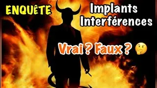 Miniature : 🤔 Implants, interférences : vrai ou faux ? 😶‍🌫️