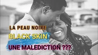 Miniature : LA PEAU NOIRE OU BLACK SKIN, UNE MALÉDICTION ???