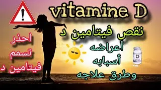 Miniature : أخطر أعراض نقص فيتامين د/أسباب وطرق علاجه/مصادر طبيعية وتحذيرات من تناوله