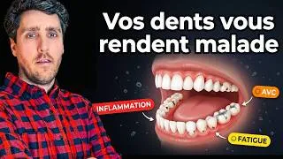 Miniature : 80% des maladies chroniques ont une origine dentaire (et personne n'en parle)