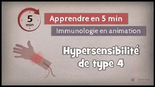 Miniature : 5-5 ◽HS de type IV