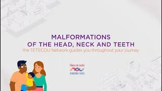 Miniature : Malformations of the head, neck and teeth - The TETECOU Network guides you throughout your journey