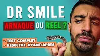 Miniature : MON AVIS SUR DR SMILE 2025 : TEST, CONSEILS ESSENTIELS ET RESULTAT AVANT/APRÈS