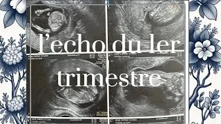 Miniature : Vlog : l’échographie du premier trimestre 