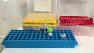 Miniature : Étape 7 Clonage par PCR : Comment réaliser une PCR sur colonies