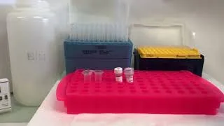 Miniature : Étape 6 Clonage par PCR : Comment réaliser une ligation et une transformation de bactéries