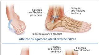 Miniature : Examen clinique complet de la cheville