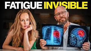 Miniature : Burn-out biologique : les vraies causes de la fatigue chronique (chlorophylle, phycocyanine)