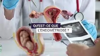 Miniature : 👩 Les charlatans de l’endométriose