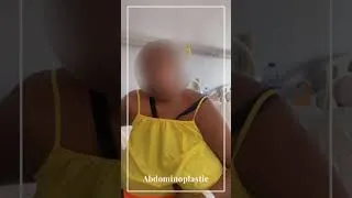 Miniature : ✨ Son abdominoplastie a été un succès !