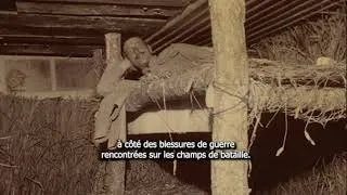 Miniature : Minute Histoire | Le pied de tranchée