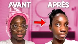 Miniature : J'ai Fait Disparaître Mon Acné et Mes Tâches en 8 semaines (Skin Care Routine Complète)