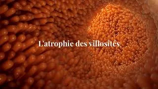 Miniature : Répare ton intestin : Le secret pour absorber enfin tes nutriments ! #microbiote   #SantéIntestinale