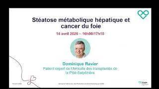 Miniature : WEBINAR | Stéatose métabolique et cancer du foie